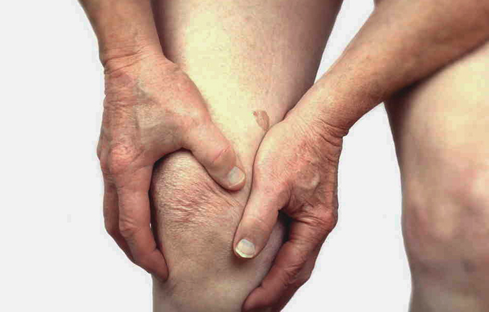 Симптом серонегативного ревматоидного артрита в колене