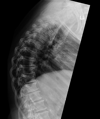 Рентген спины