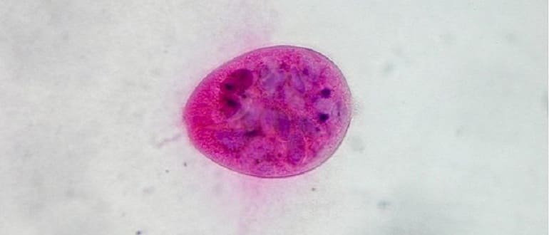 Balantidium coli.