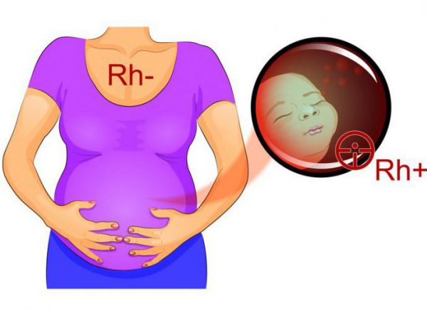 Симптомы и лечение гломерулонефрита при беременности