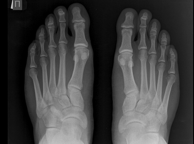Снимок пальцев ног