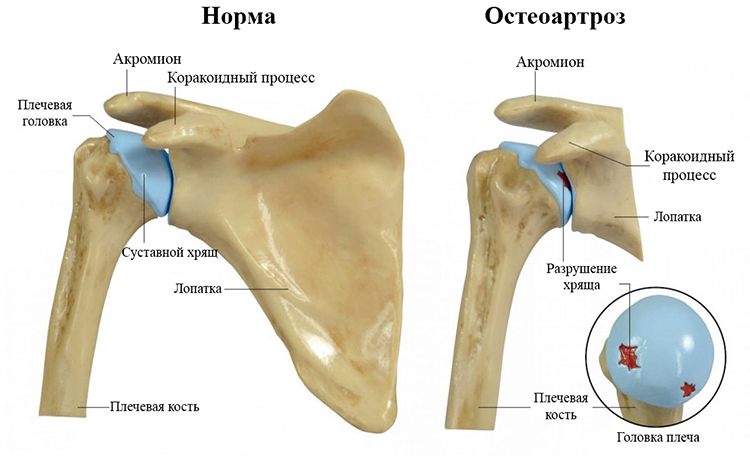 Суставы и мышцы плечевого сустава анатомия